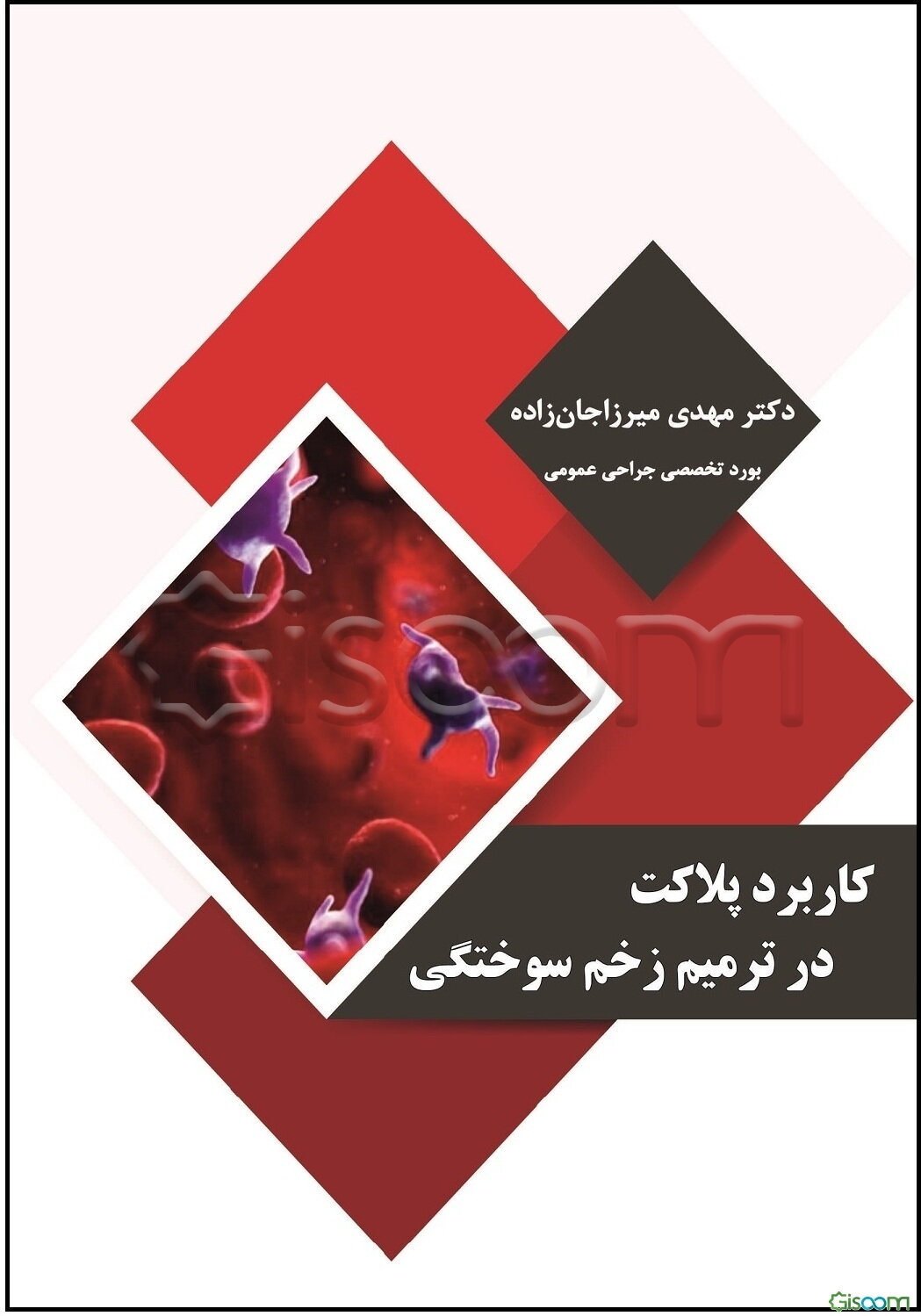 کاربرد پلاکت در ترمیم زخم سوختگی